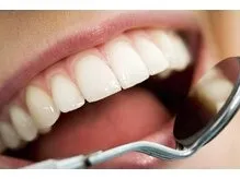 ナチュラルな白い歯を目指せるホワイトニング
